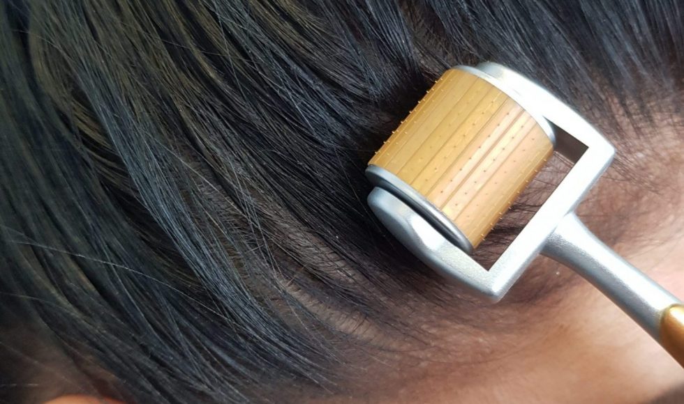 معالجة الشعر بتقنية الديرما رولر