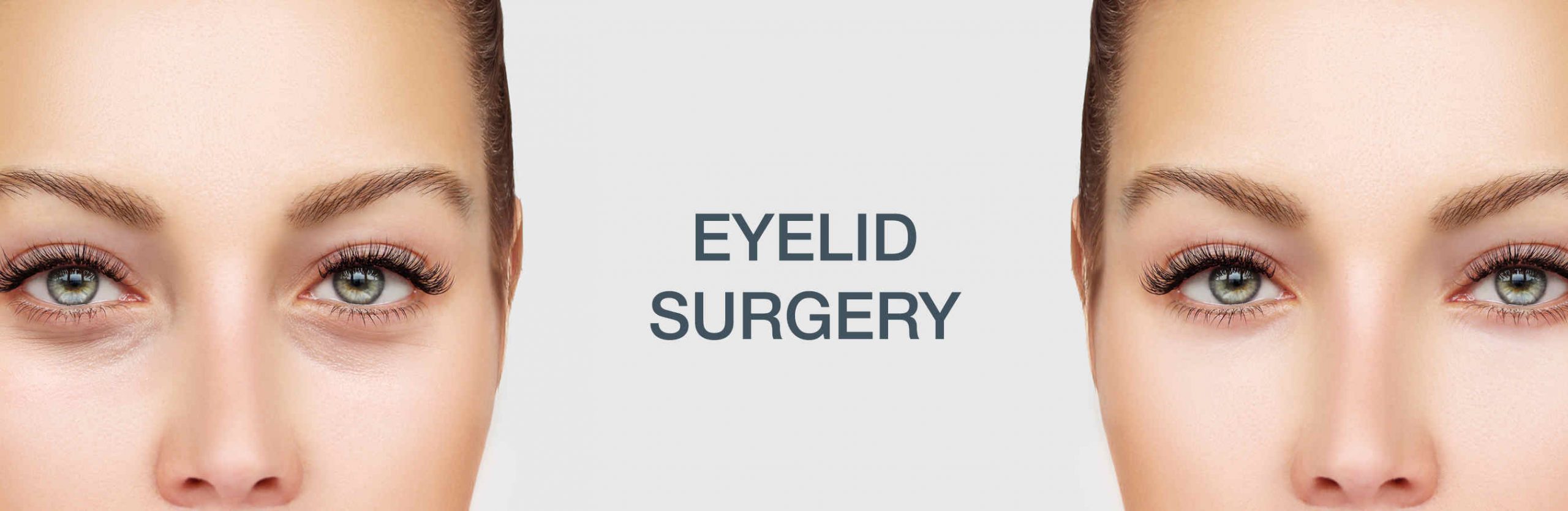 eyelid lift surgery