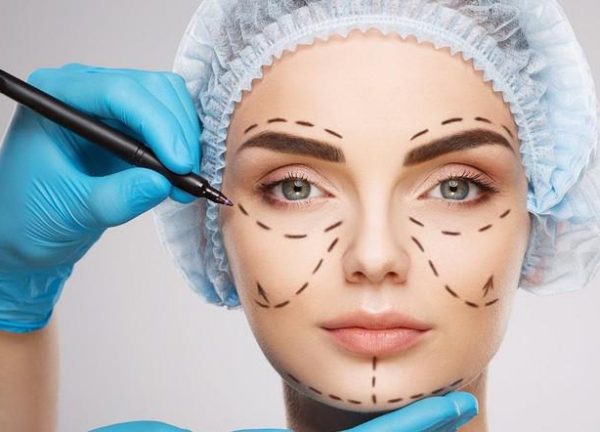 facelift operation