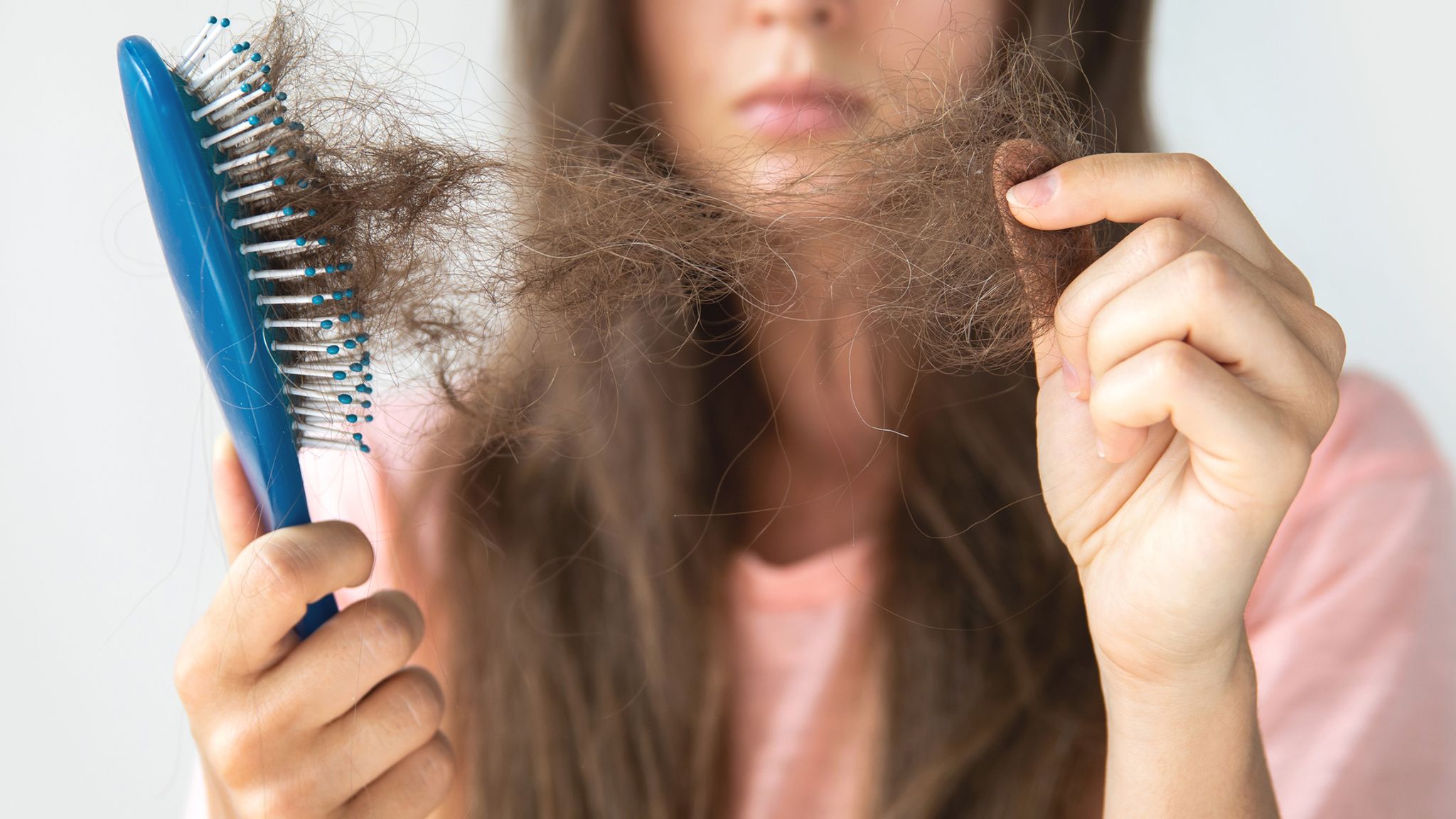 عمليات زراعة الشعر للنساء