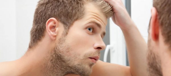 male hair transplant 1