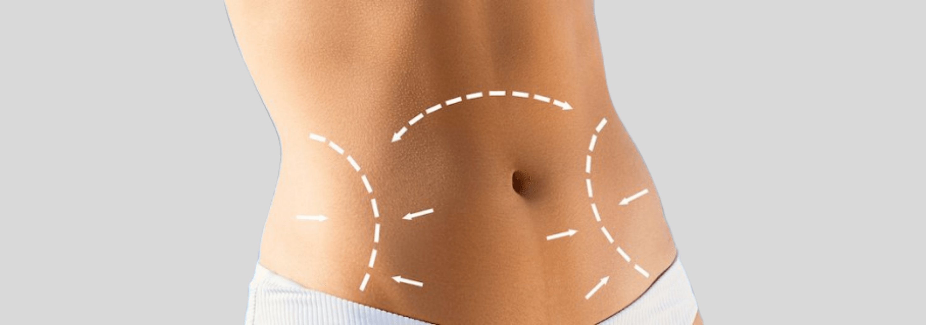 Overview About Tummy Lift Surgery