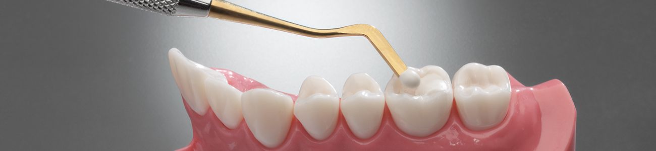 Dental composite resins
