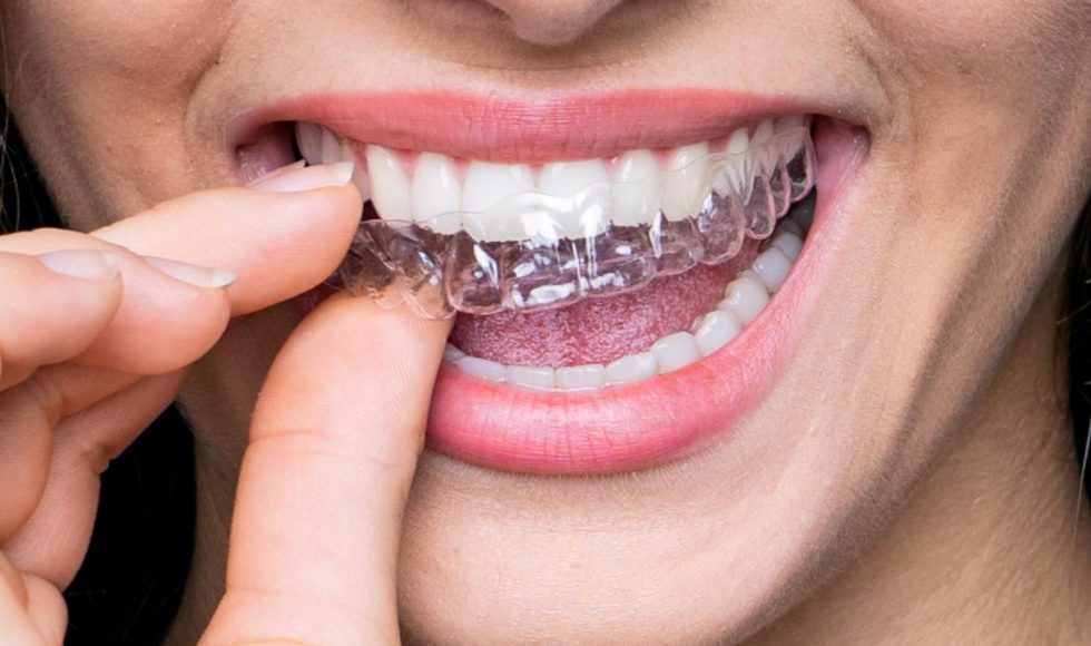 https://healingclinicturkey.com/wp-content/uploads/2021/01/transparent-teeth-braces-980x580.jpg