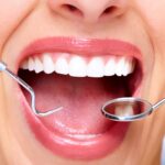 operaciones de dientes