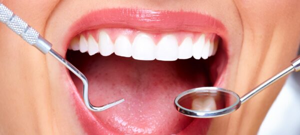 operaciones de dientes